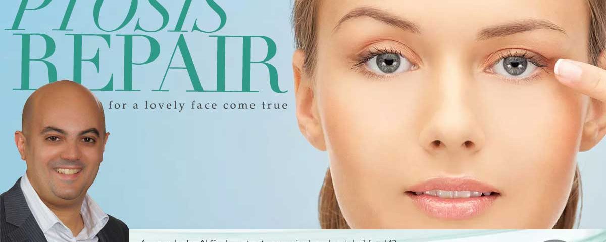 هل ارتخاء جفن العين يستلزم التدخل الجراحي دائما؟