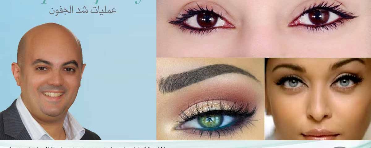 تكلفة عمليات تجميل العيون في الأردن