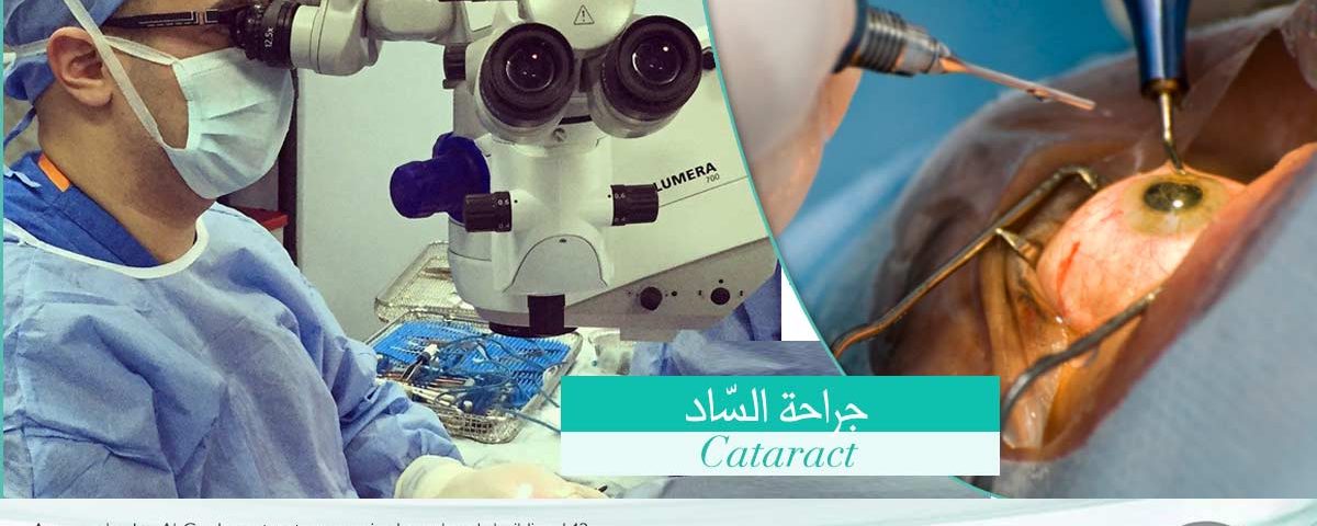 الساد أو الماء الأبيض او الماء الأزرق هو إعتام عدسة العين خطوات إجراء الفاكو