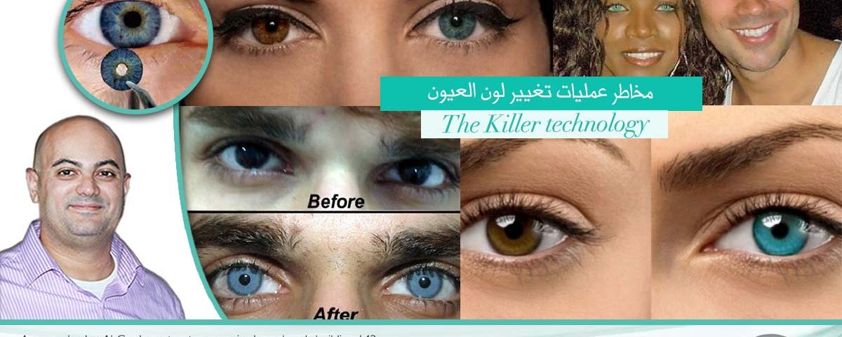هل أنت مصرة بعد علي عمليات العيون الملونة ؟