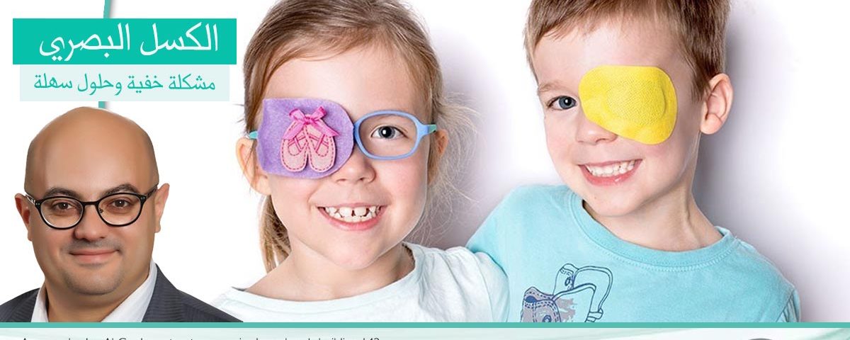  العين الكسولة ، أو الكسل البصري أو كسل العين الوظيفي ، إأنخفاض حدة الأبصار ،حتى بمساعدة النظارات وذلك بسبب عدم تعرف الدماغ علي العين بالمراحل الأولي للعمر