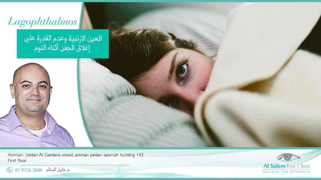 النوم والعين مفتوحة من الأمراض الشائعة جدا ، لها أسماء عدة منها : العين الأرنبية نوم الغزلان أو النوم الغزلاني أو النوم بنصف عين مفتوحة 