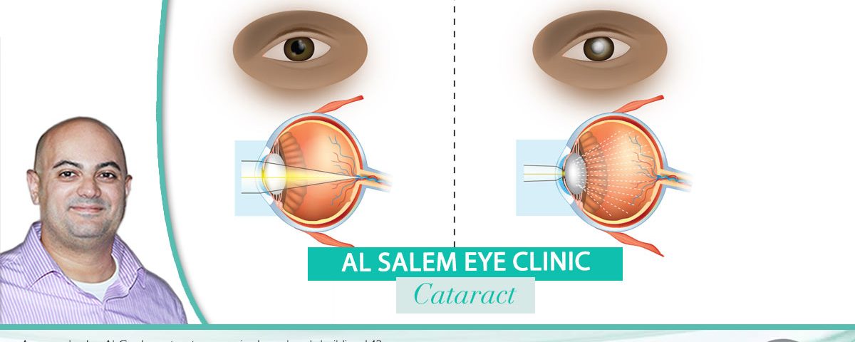 Treat your eyes to today with the best surgeon in Jordan Dr. Khalil Al-Salem