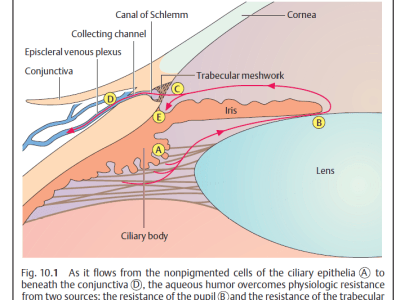 Glaucoma, increased intraocular pressure (IOP). The two main types are open-angle glaucoma and angle-closure glaucoma. medical students